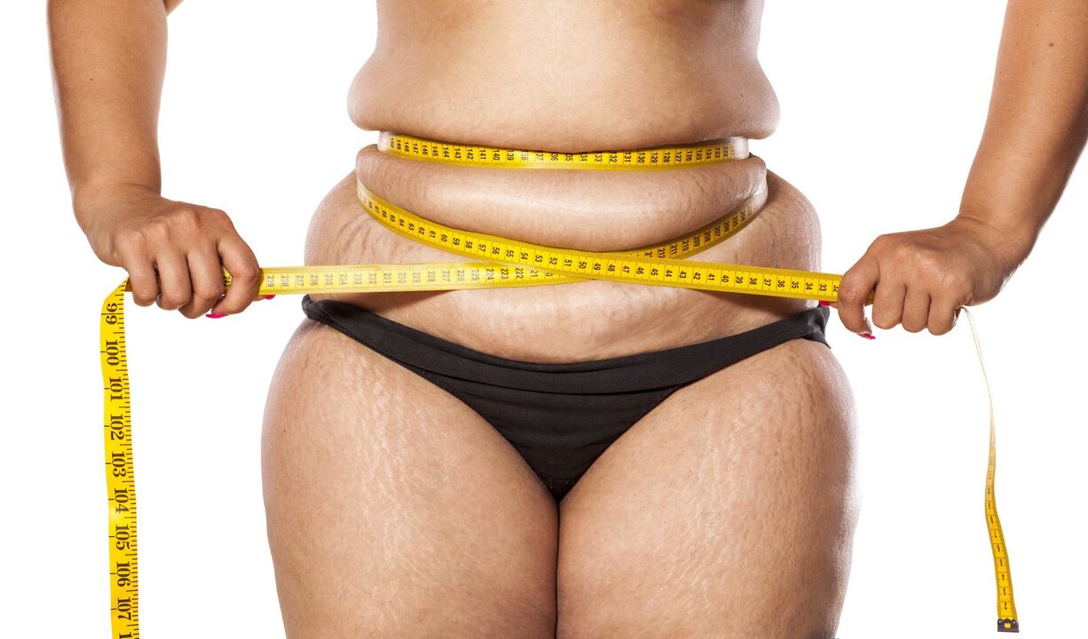 Excess weight and weight loss using ZXCVBNMQWER